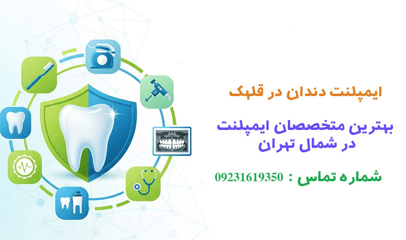 ایمپلنت-در-قلهک