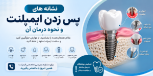 علائم پس زدن ایمپلنت